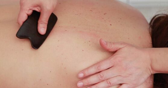 Traditional Chinese medicine Gua Sha